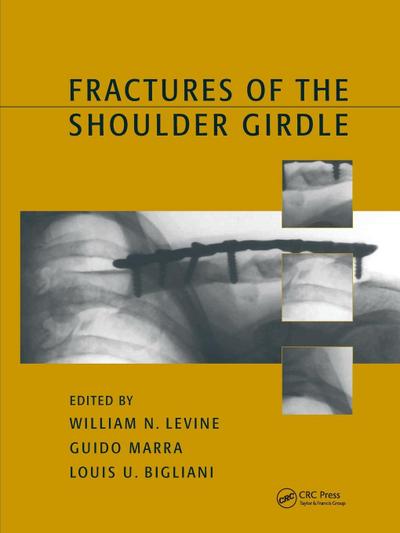 Fractures of the Shoulder Girdle