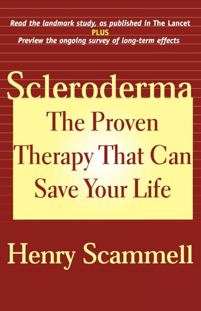 Scammell, H: Scleroderma