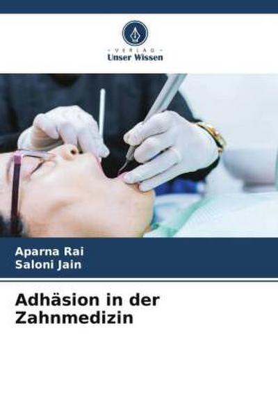 Adhäsion in der Zahnmedizin