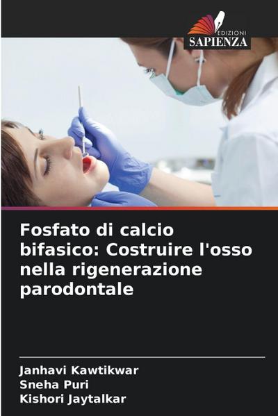 Fosfato di calcio bifasico: Costruire l’osso nella rigenerazione parodontale