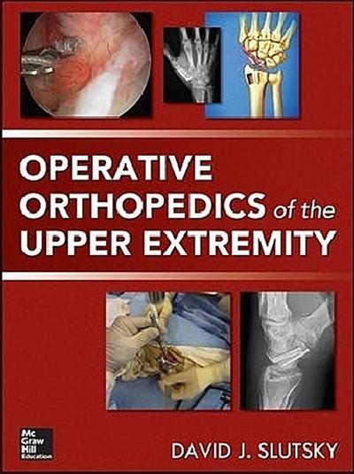 Operative Orthopedics of the Upper Extremity