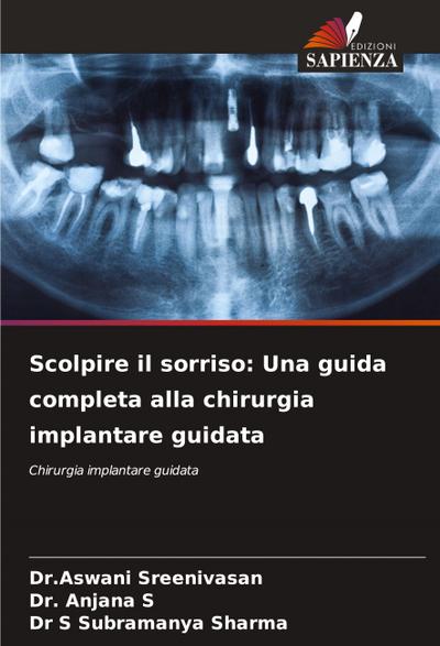 Scolpire il sorriso: Una guida completa alla chirurgia implantare guidata