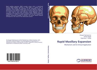 Rapid Maxillary Expansion