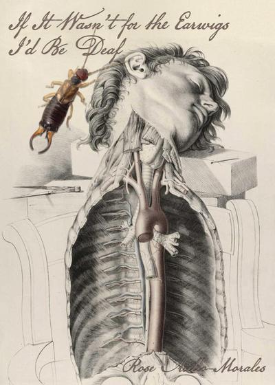 If It Wasn’t for the Earwigs I’d Be Deaf