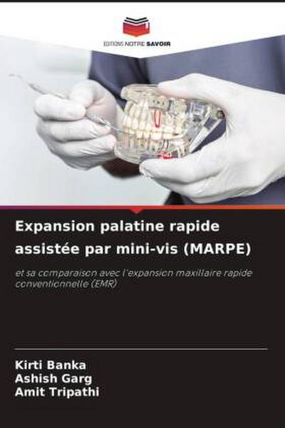 Expansion palatine rapide assistée par mini-vis (MARPE)