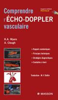 Comprendre l’Echo-Doppler vasculaire