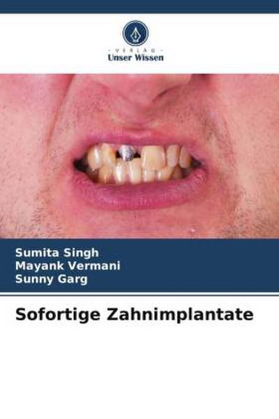 Sofortige Zahnimplantate