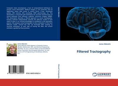 Filtered Tractography