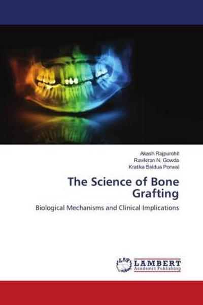 The Science of Bone Grafting