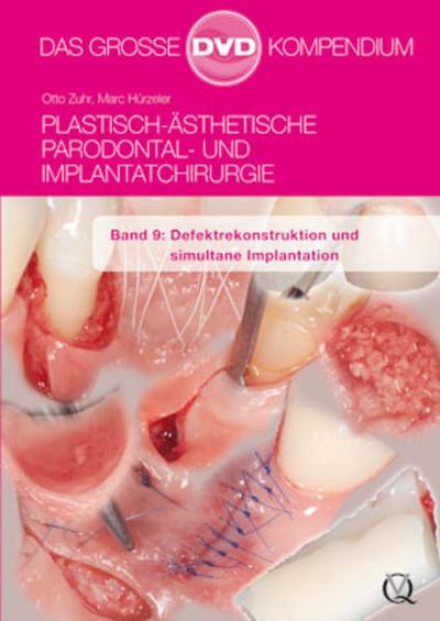 Plastisch-Ästhetische Parodontal- und Implantatchirurgie
