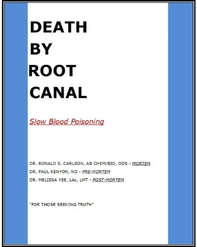 Death By Root Canal