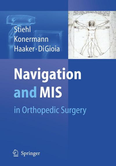 Navigation and MIS in Orthopaedic Surgery