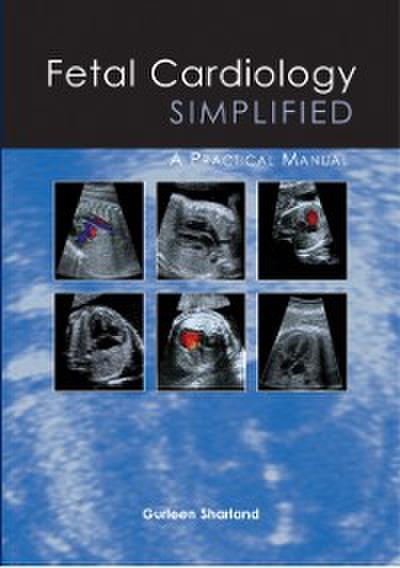 Fetal Cardiology Simplified