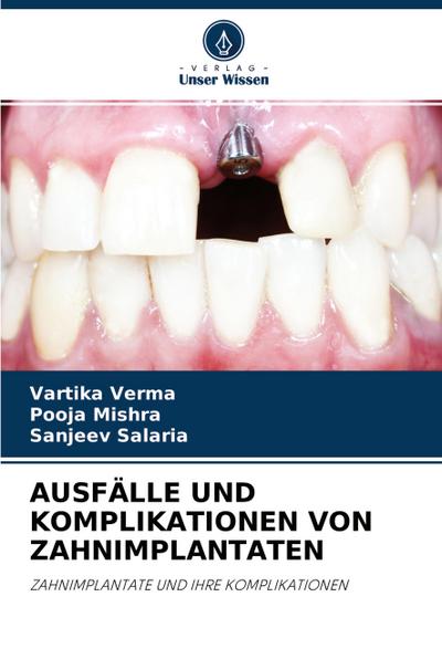 AUSFÄLLE UND KOMPLIKATIONEN VON ZAHNIMPLANTATEN