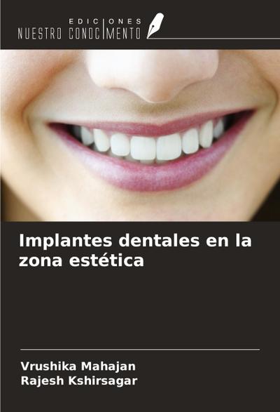 Implantes dentales en la zona estética