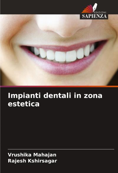 Impianti dentali in zona estetica