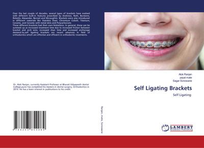 Self Ligating Brackets