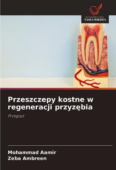 Przeszczepy kostne w regeneracji przyz¿bia