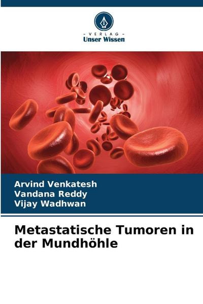 Metastatische Tumoren in der Mundhöhle
