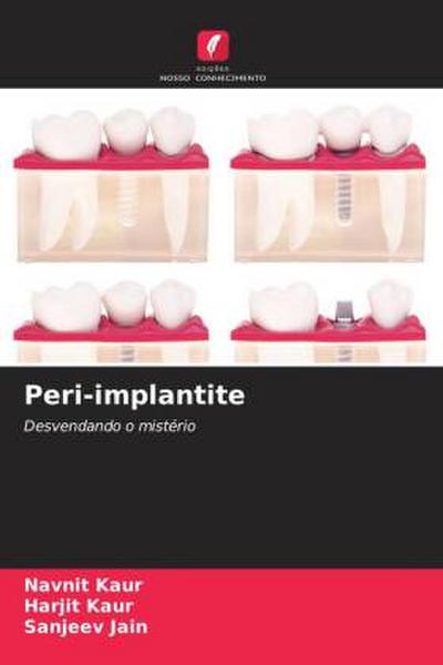 Peri-implantite