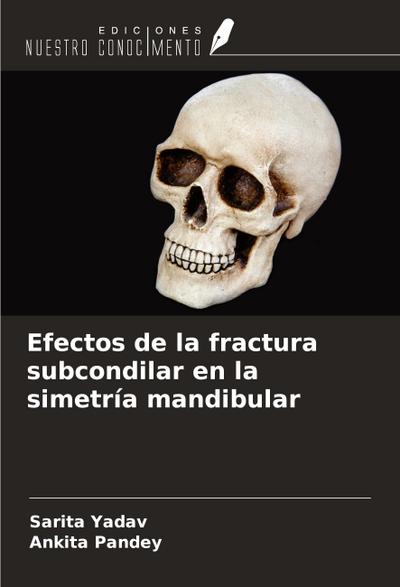 Efectos de la fractura subcondilar en la simetría mandibular