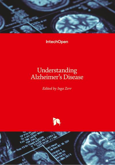 Understanding Alzheimer’s Disease