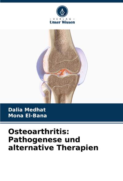 Osteoarthritis: Pathogenese und alternative Therapien
