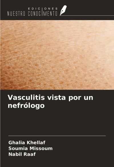 Vasculitis vista por un nefrólogo