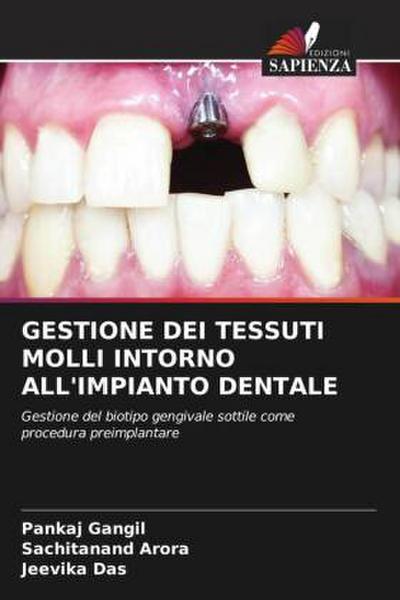 GESTIONE DEI TESSUTI MOLLI INTORNO ALL’IMPIANTO DENTALE