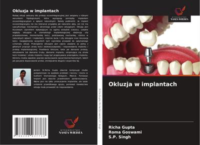Okluzja w implantach