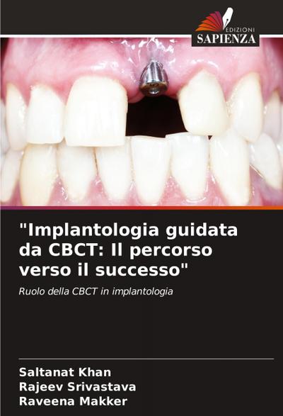 "Implantologia guidata da CBCT: Il percorso verso il successo"