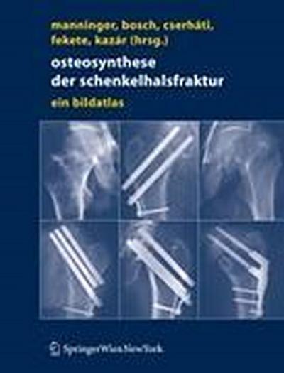 Osteosynthese der Schenkelhalsfraktur