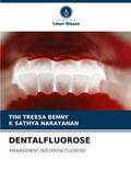 DENTALFLUOROSE