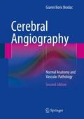 Cerebral Angiography