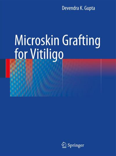 Microskin Grafting for Vitiligo