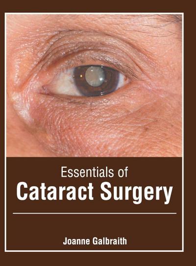 Essentials of Cataract Surgery