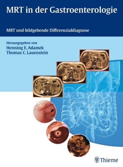 MRT in der Gastroenterologie: MRT und bildgebende Differenzialdiagnose