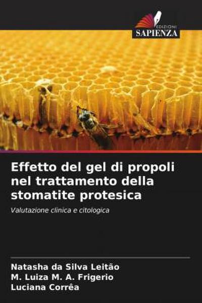 Effetto del gel di propoli nel trattamento della stomatite protesica