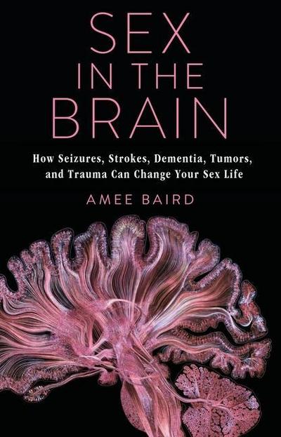 Sex in the Brain