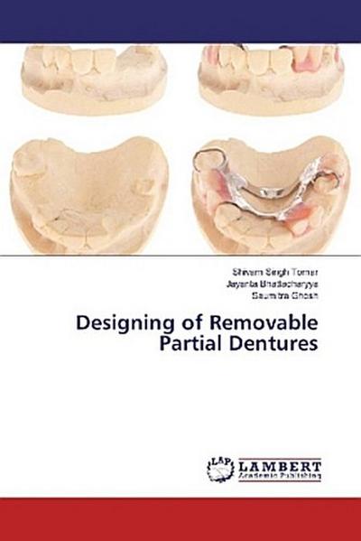 Designing of Removable Partial Dentures