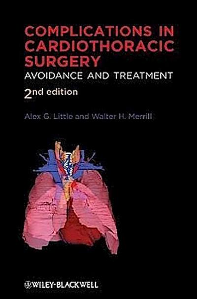 Complications in Cardiothoracic Surgery
