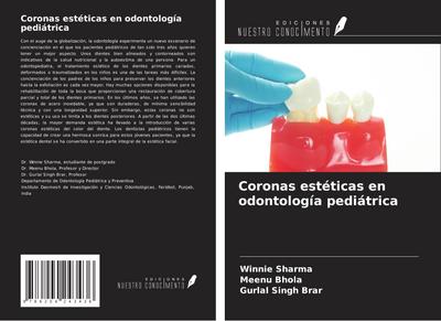 Coronas estéticas en odontología pediátrica