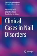 Clinical Cases in Nail Disorders