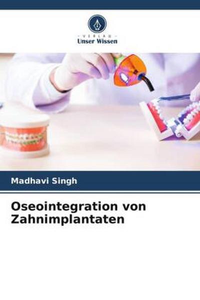 Oseointegration von Zahnimplantaten