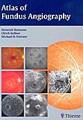 Atlas of Fundus Angiography