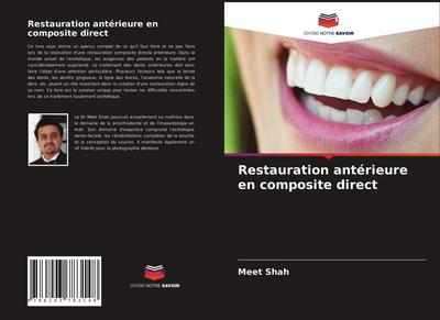 Restauration antérieure en composite direct