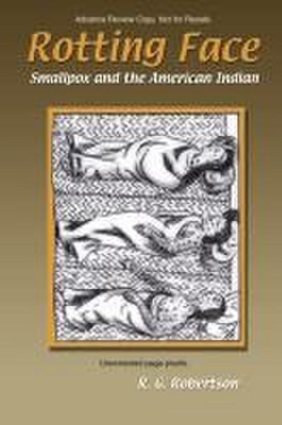 Rotting Face: Smallpox and the American Indian