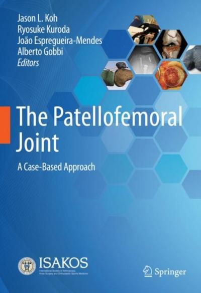 The Patellofemoral Joint