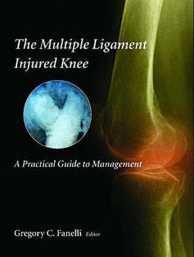 The Multiple Ligament Injured Knee