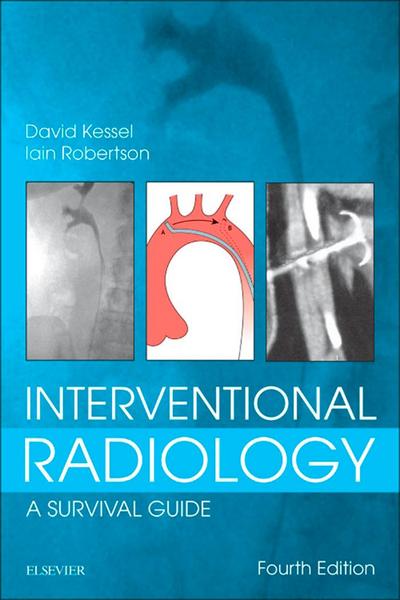 Interventional Radiology: A Survival Guide E-Book